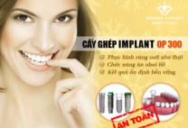 Kết quả cắm răng implant duy trì được bao lâu?