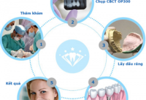 Công nghệ cấy ghép Implant tại Nha khoa Quốc tế Dencos Luxury
