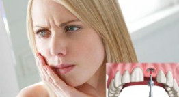 Cấy răng implant có đau không? – Xem tại đây