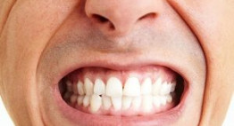 Bạn đã biết hết các cách chữa bệnh nghiến răng cho mình hay chưa?