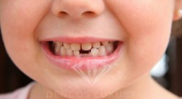 Lựa chọn địa chỉ nhổ răng cho bé an toàn, nhẹ nhàng và không đau