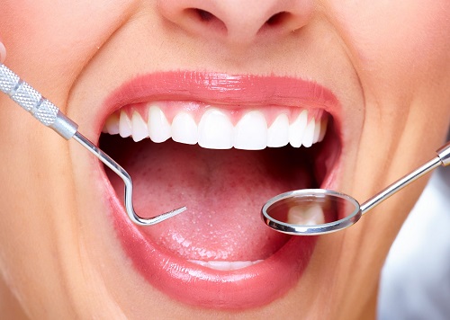 ưu điểm của cấy ghép răng implant 2